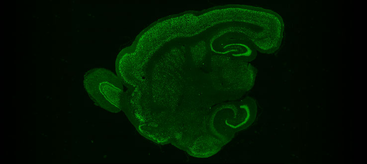 Sagittal section of bat brain stained with NeuN, a marker for neurons. The olfactory bulb is to the left (front) and the dorsal and ventral parts of the hippocampus are seen to the right (back) of the forebrain.