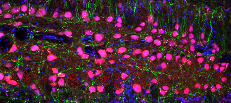 Prominent tyrosine hydroxylase - immunoreactive fibers (green) surround and contact neurobiotin (red)-filled vocal motor neurons (pink) in a horizontal section through the hindbrain-spinal cord of a plainfin midshipman fish.