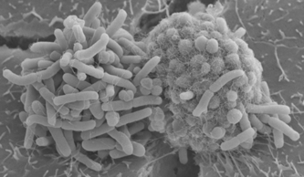 Microcolonies of <em>Neisseria elongata</em> (left) and <em>Neisseria gonorrhoeae</em> (right) interacting on human epithelium.
