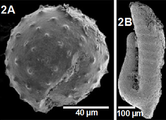 SEM images of Tully Formation microfossils. 2A: <em>Solisphaeridium</em>, an acritarch common in the Devonian of the Appalachian Seaway but of uncertain affinity. May be an alga. 2B: <em>Jinonicella kolebabai</em>, an animal of unknown affinities. The Tully specimens are the only known occurrences of microfossil in North America.